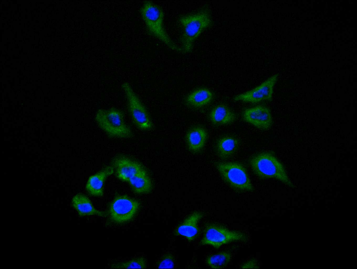 CSB-RA010145MA1HU