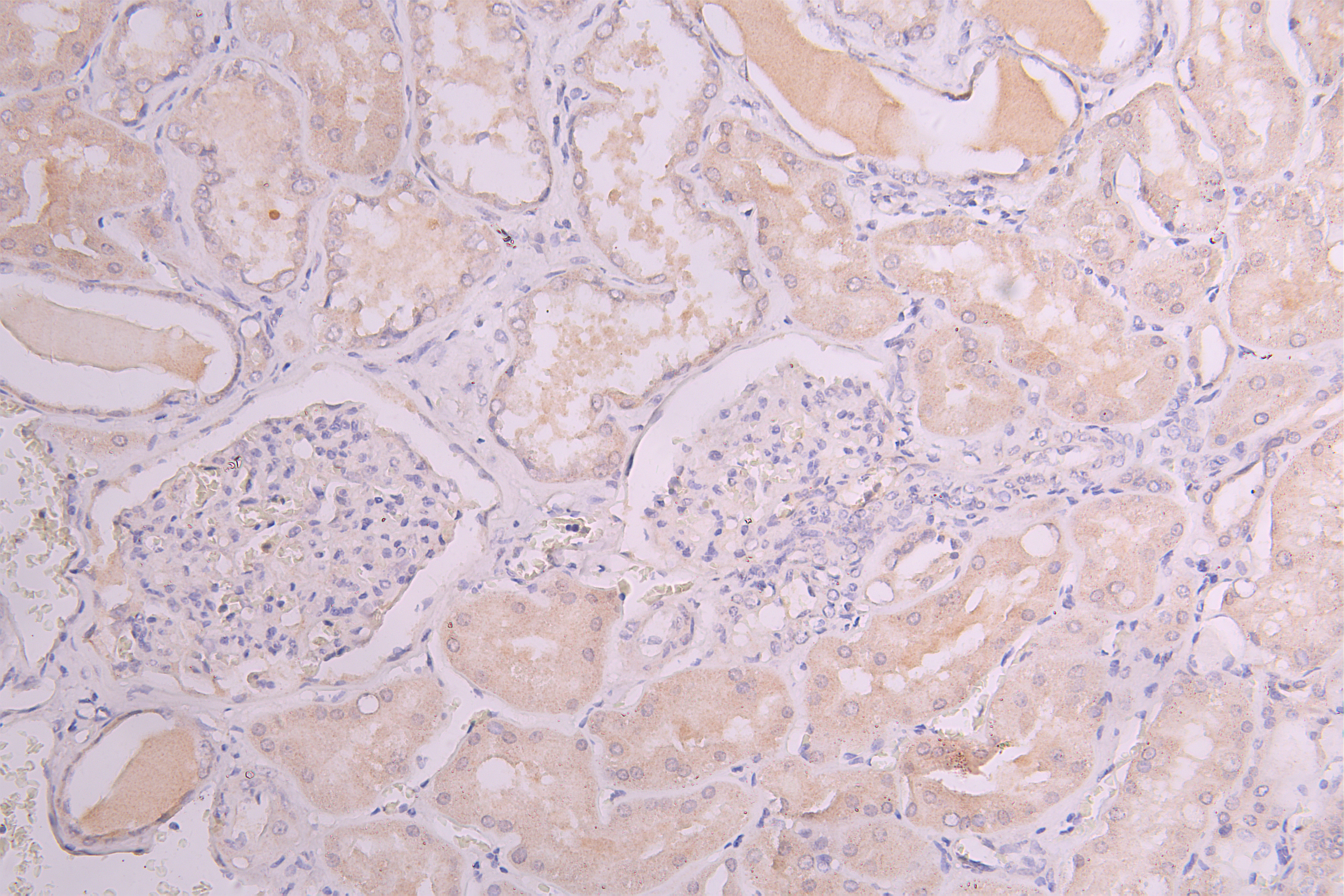 CSB-RA010327MA1HU