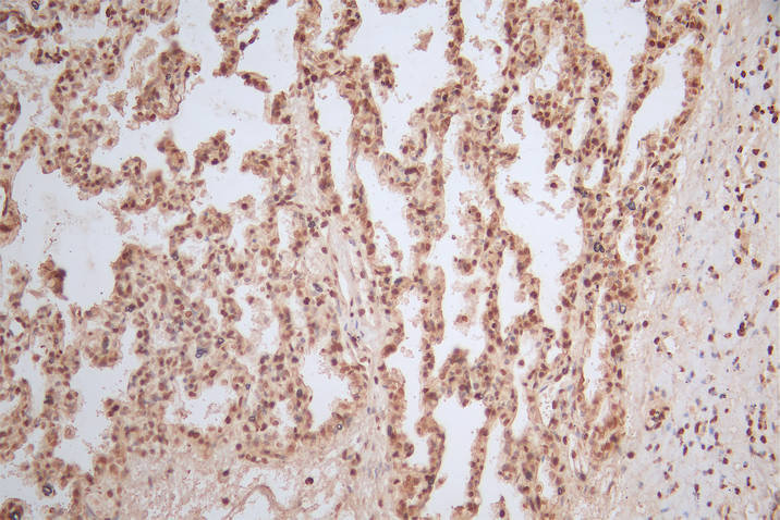 CSB-RA010429MA1HU