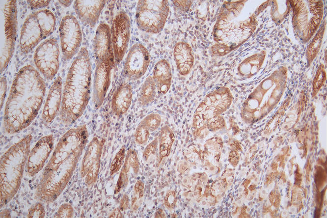 CSB-RA010429MA1HU