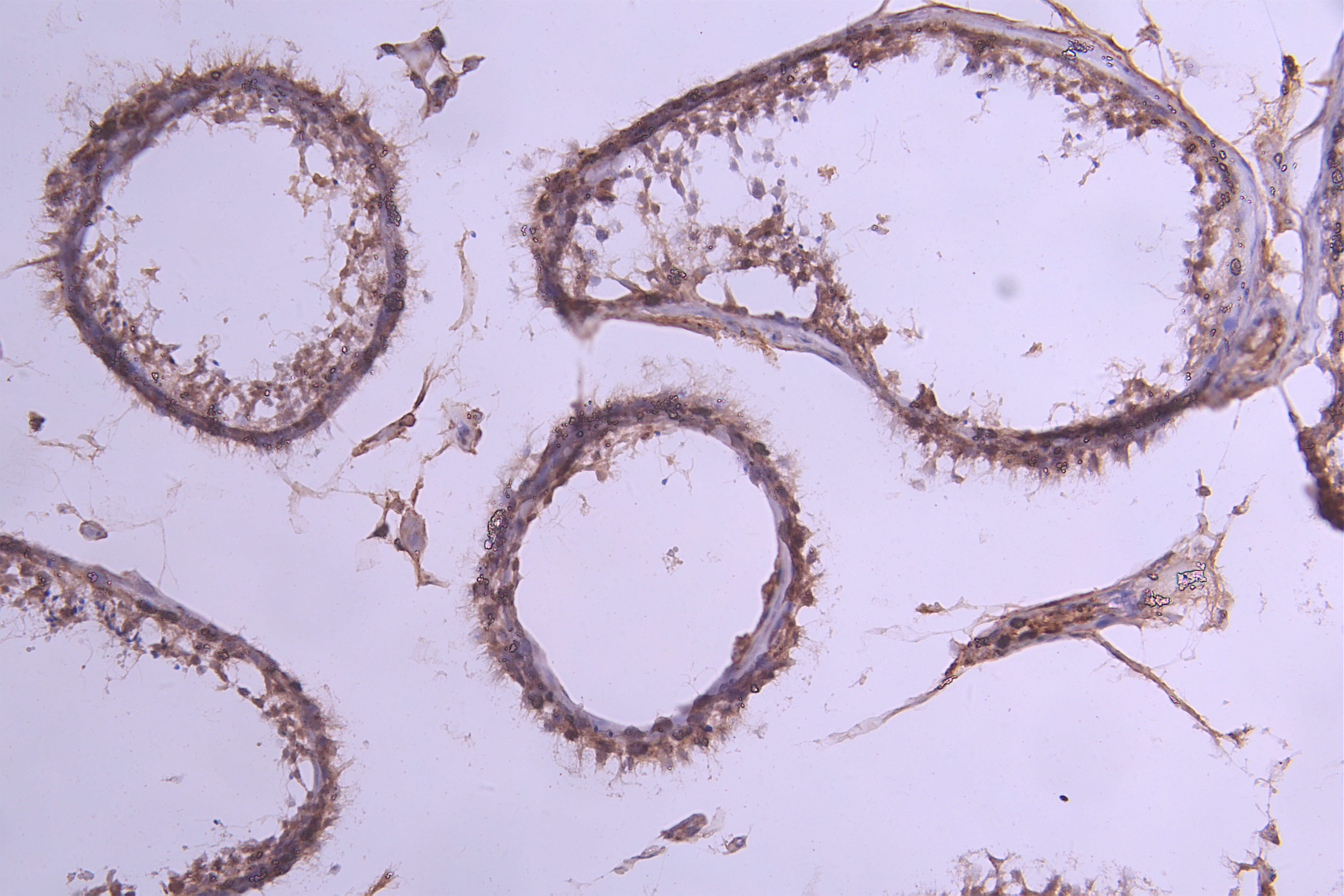 CSB-RA011580MA1HU