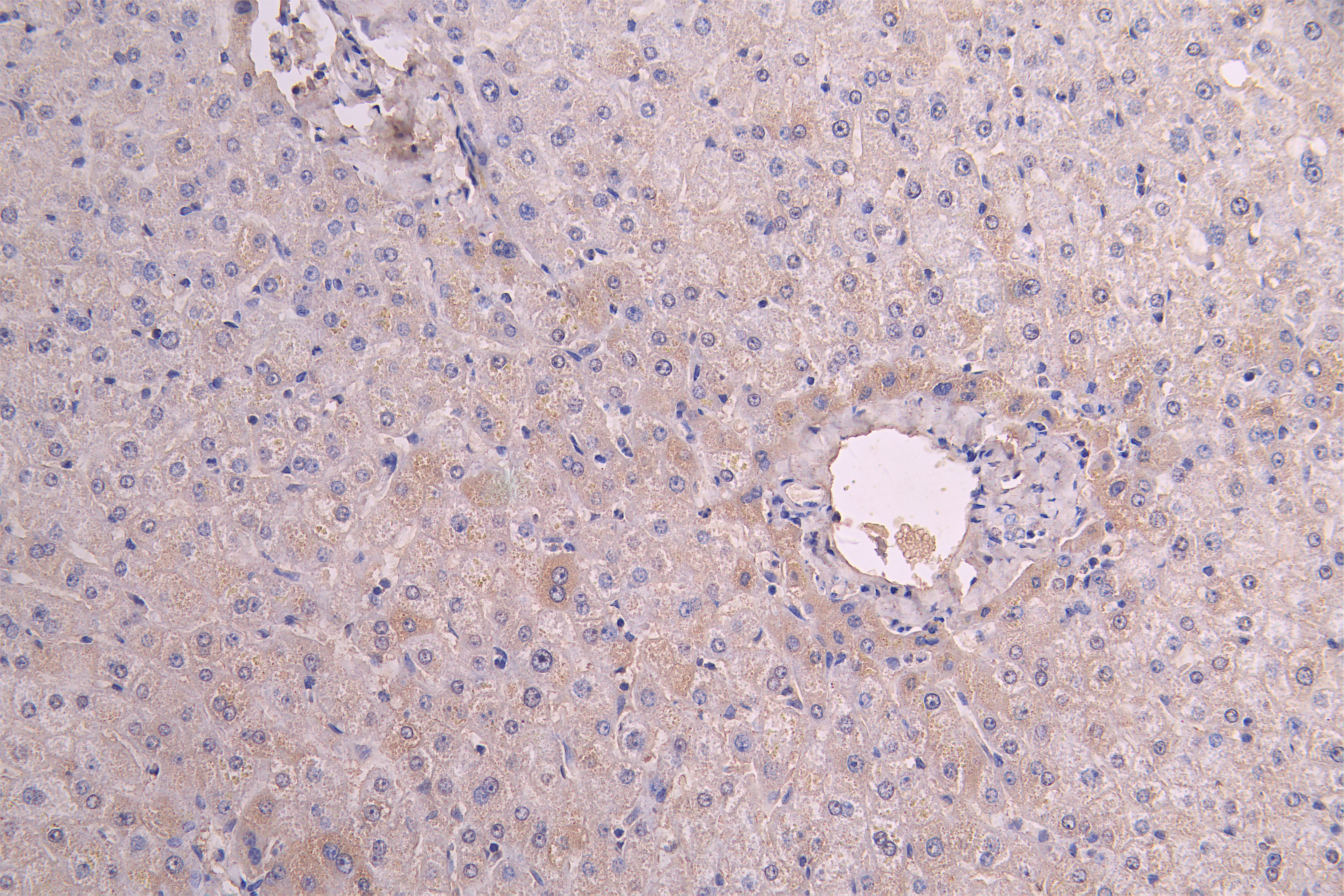 CSB-RA011591MA1HU
