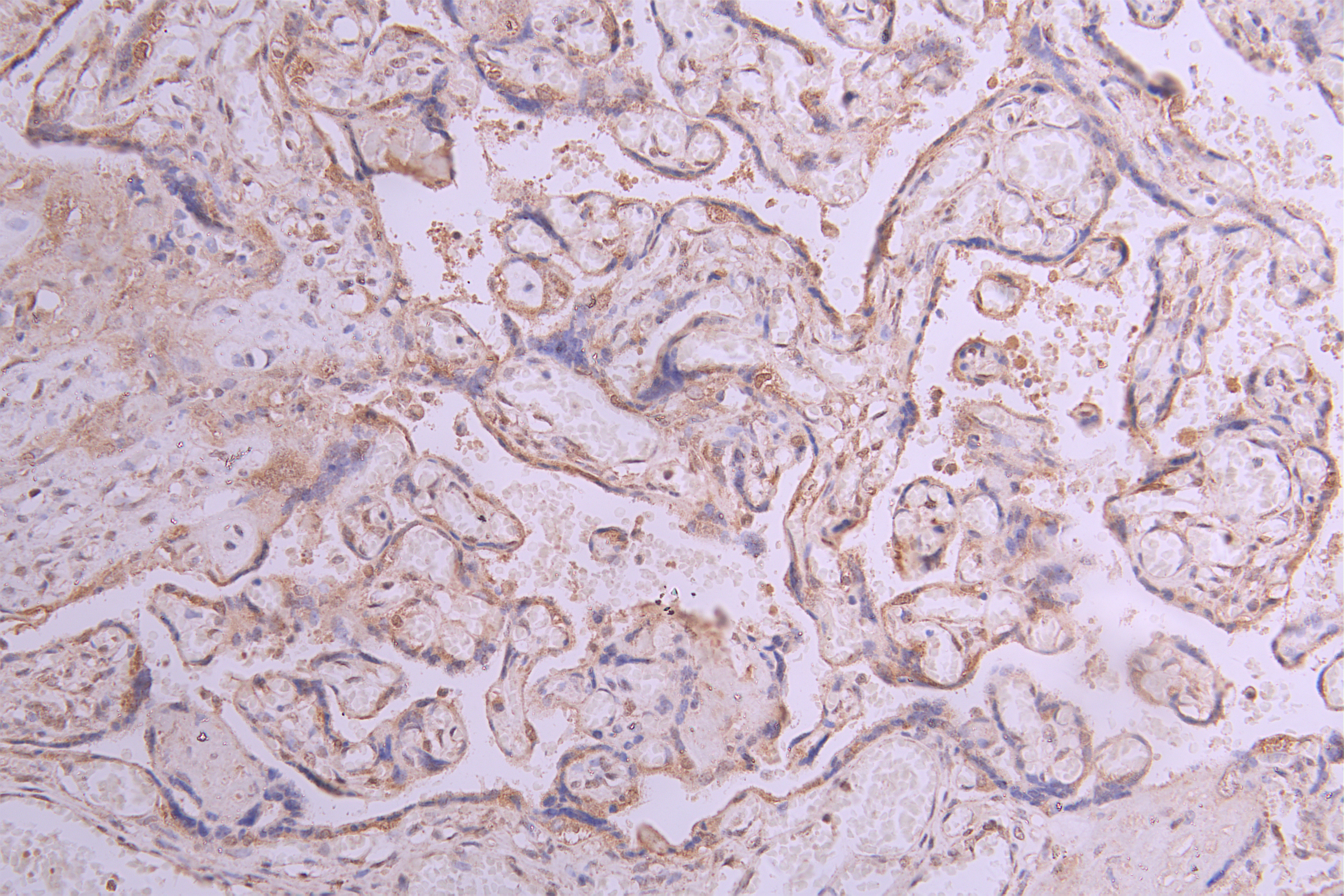 CSB-RA011868MA1HU