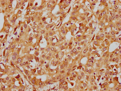 CSB-RA011880A0HU