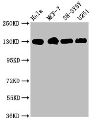CSB-RA011880A0HU