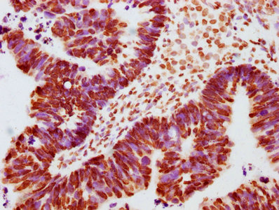 CSB-RA011931A100phHU IHC
