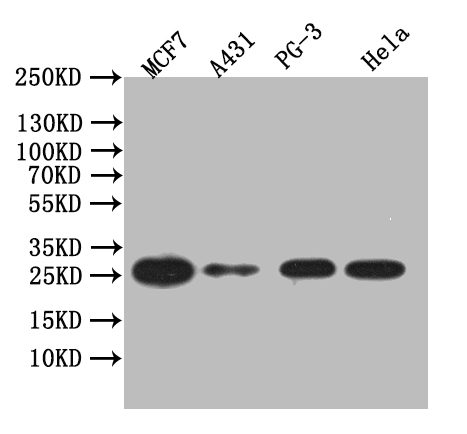 CSB-RA012887MA1HU