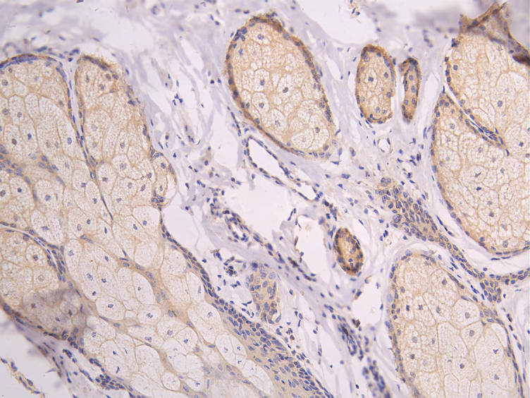 CSB-RA012936MA1HU