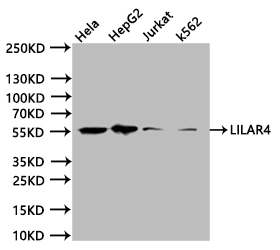 CSB-RA012936MA1HU