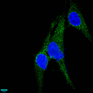 CSB-RA013563A0HU IF