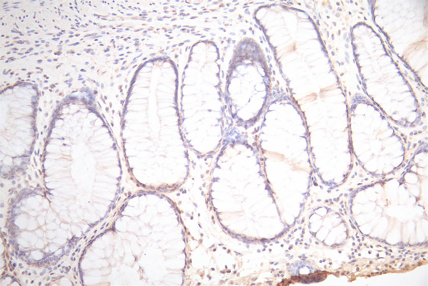 CSB-RA017739MA1HU