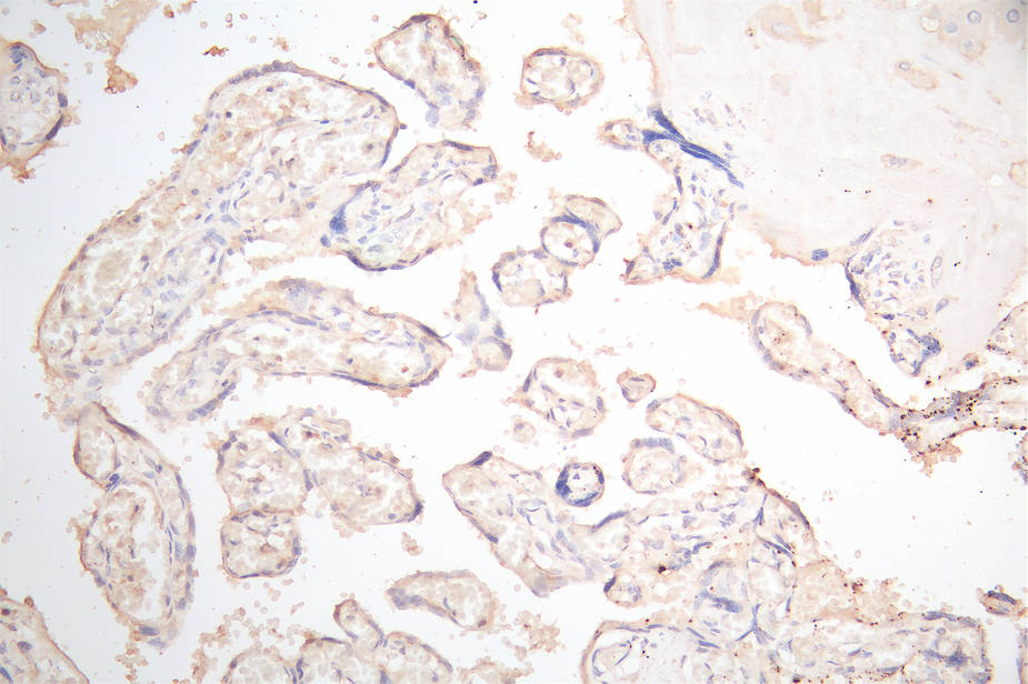 CSB-RA017739MA1HU