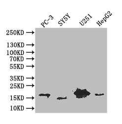 CSB-RA017739MA1HU