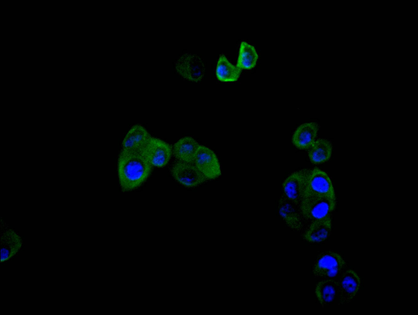 CSB-RA018122MA1HU