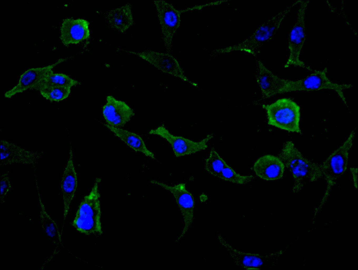 CSB-RA018122MA1HU