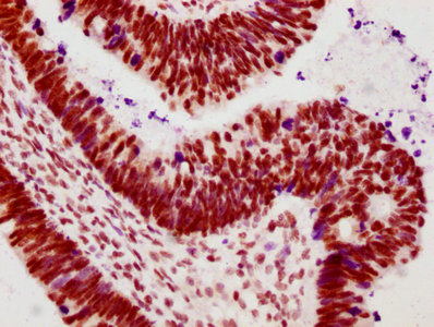 CSB-RA018327A02phHU