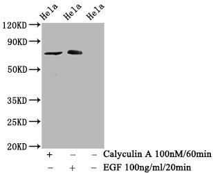 CSB-RA019284A621phHU