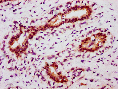 CSB-RA022814A694phHU