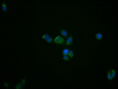 CSB-RA025168A0HU