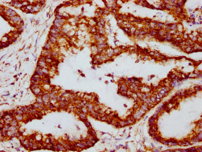 CSB-RA025168A0HU