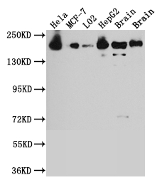 CSB-RA152329A0HU