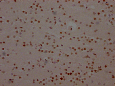 CSB-RA152430A0HU