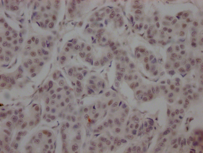 CSB-RA152430A0HU