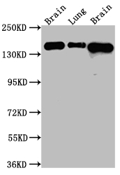 CSB-RA154582A0HU