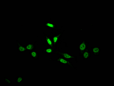 CSB-RA155372A0HU