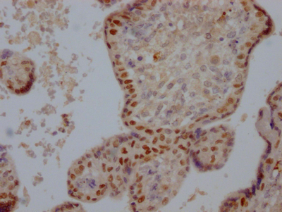 CSB-RA160202A0HU