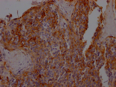 CSB-RA162789A0HU