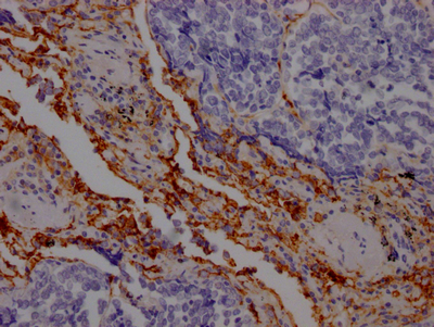 CSB-RA162789A0HU