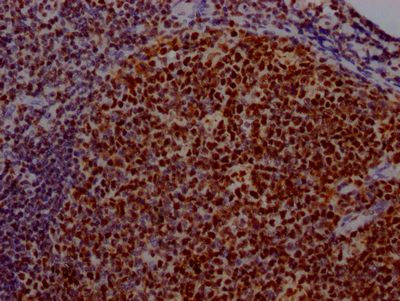 CSB-RA192026A0HU