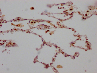 CSB-RA198316A0HU