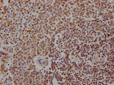 CSB-RA198316A0HU