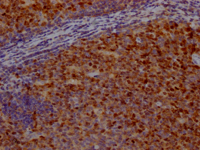 CSB-RA209144A0HU