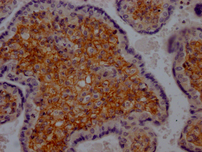 CSB-RA213932A0HU