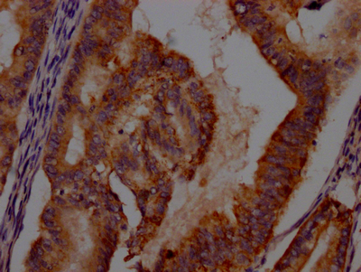 CSB-RA215054A0HU