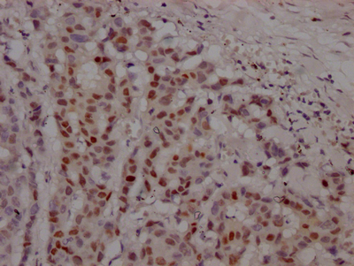 CSB-RA217661A0HU
