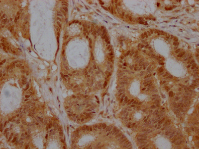 CSB-RA218051A0HU