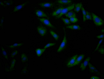 CSB-RA225569A0HU