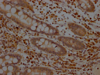 CSB-RA225579A0HU