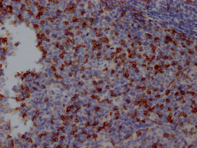 CSB-RA240597A0HU