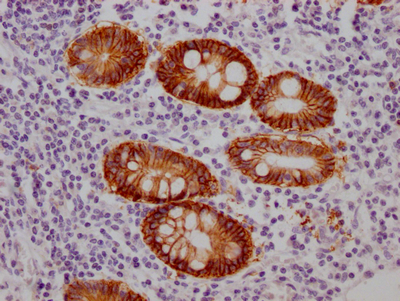 CSB-RA245537A0HU