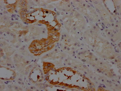 CSB-RA263831A0HU