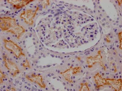 CSB-RA268157A0HU
