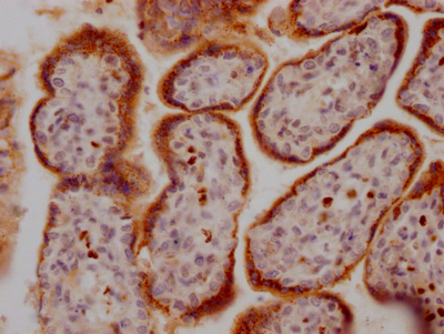 CSB-RA285852A0HU