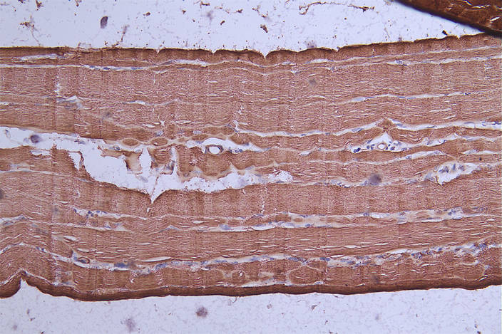 CSB-RA289956A0HU
