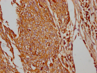 CSB-RA297401A0HU