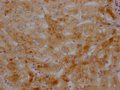 CSB-RA437590A0HU